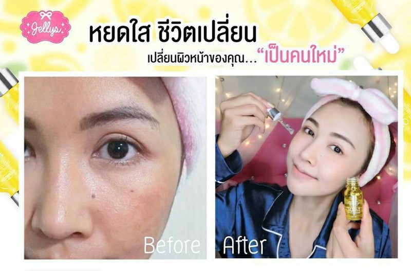 เซรั่มวิตามินซี ยี่ห้อไหนดีที่สุด